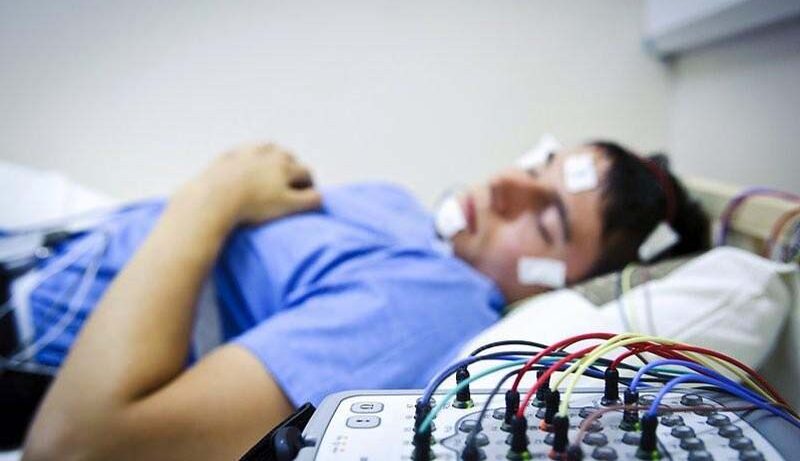 Uyku EEG Çekimi, Evde EEG nedir, Mobil eeg nedir,